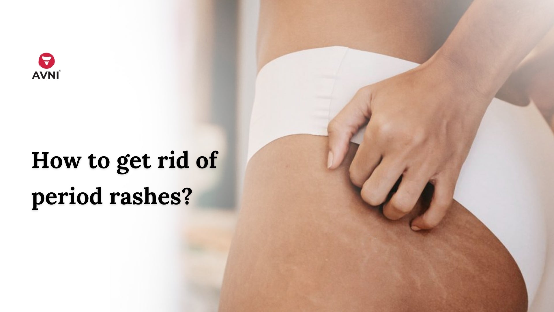 Pad rash: Appearance, causes, treatment, and more